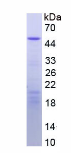 Figure. SDS-PAGE