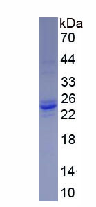 Figure . SDS-PAGE