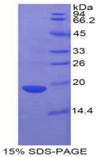 Figure . SDS-PAGE