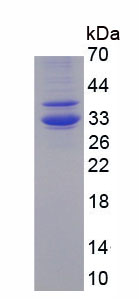 Figure . SDS-PAGE