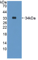 Figure . Western Blot