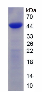 Figure . SDS-PAGE