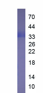 Figure. SDS-PAGE