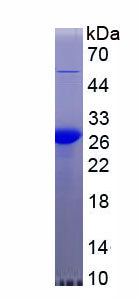 Figure . SDS-PAGE