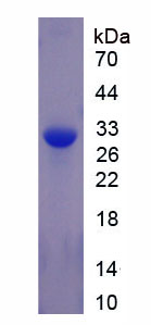 Figure . SDS-PAGE