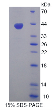 Figure. SDS-PAGE