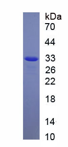 Figure. SDS-PAGE