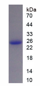 Figure . SDS-PAGE