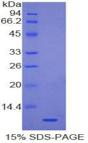 Figure . SDS-PAGE