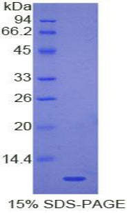 Figure . SDS-PAGE