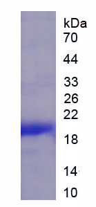 Figure . SDS-PAGE