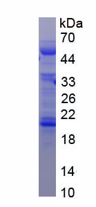 Figure . SDS-PAGE