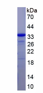 Figure . SDS-PAGE