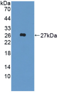 Figure . Western Blot