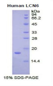 Figure . SDS-PAGE