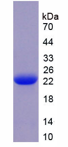 Figure . SDS-PAGE