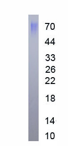 Figure. SDS-PAGE