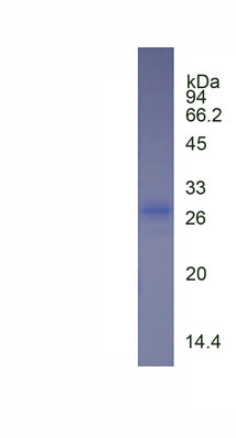 Figure. SDS-PAGE