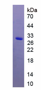 Figure. SDS-PAGE