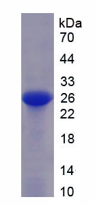 Figure . SDS-PAGE