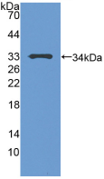 Figure . Western Blot