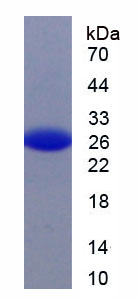 Figure . SDS-PAGE