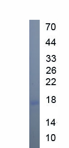 Figure. SDS-PAGE