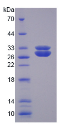 Figure . SDS-PAGE