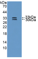 Figure . Western Blot