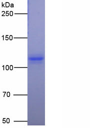 Figure. SDS-PAGE