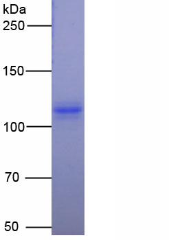 Figure. SDS-PAGE