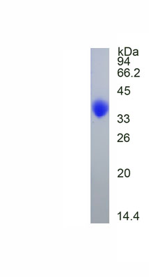 Figure. SDS-PAGE