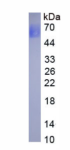 Figure. SDS-PAGE