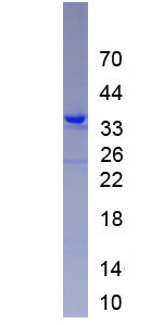 Figure. SDS-PAGE