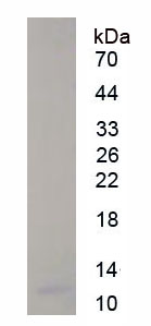 Figure . SDS-PAGE