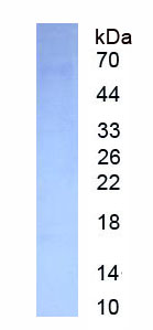 Figure . SDS-PAGE