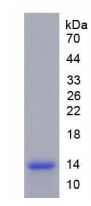 Figure . SDS-PAGE