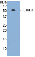 Figure . Western Blot