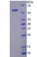 Figure . SDS-PAGE