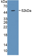 Figure . Western Blot