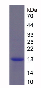 Figure . SDS-PAGE