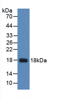 Figure . Western Blot