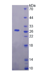 Figure . SDS-PAGE