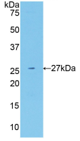 Figure . Western Blot