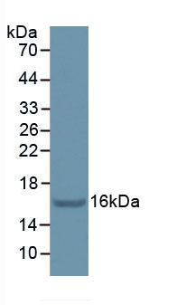 Figure . Western Blot