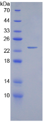 Figure . SDS-PAGE