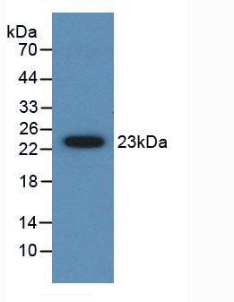 Figure . Western Blot