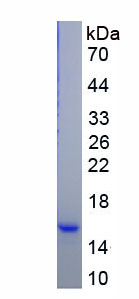 Figure. SDS-PAGE