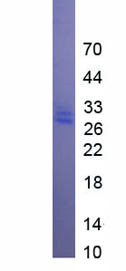 Figure. SDS-PAGE