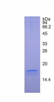 Figure. SDS-PAGE
